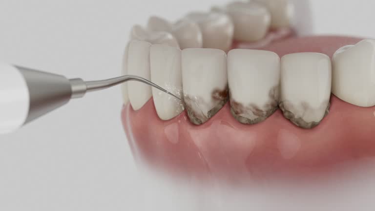 Reliable Dental contractor in Salem, IL by Dentist Open Now